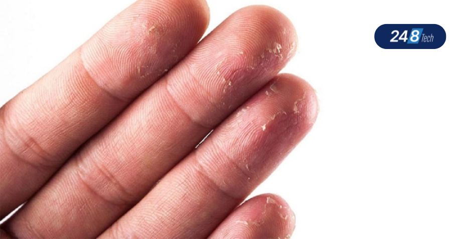 Dấu vân tay bị ảnh hưởng do điều kiện làm việc, thời tiết